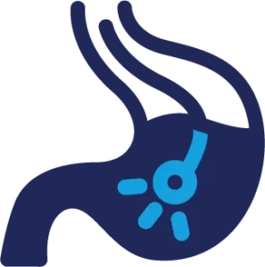 Nội soi tiêu hoá - dạ dày