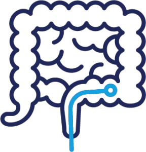 Nội soi tiêu hoá