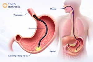 Nội goi gây mê là gì? Có an toàn không? Ưu nhược điểm cần biết